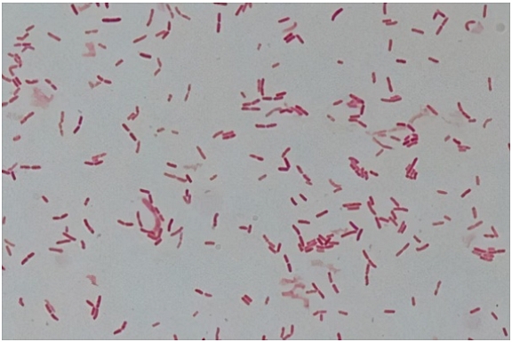 岛津微生物鉴定系统可对唐菖蒲伯克霍尔德菌进行鉴定